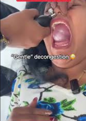 sinüsleri balonla açma